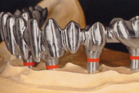 ESTRUCTURA METÁLICA: Cómo prepararla antes de cargarla.